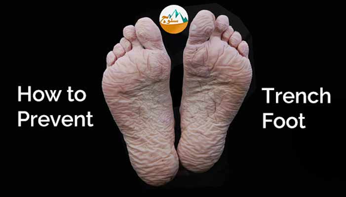 عارضه  Trench foot را بهتر بشناسیم؟ عارضه پا سنگری را چگونه درمان کنیم؟